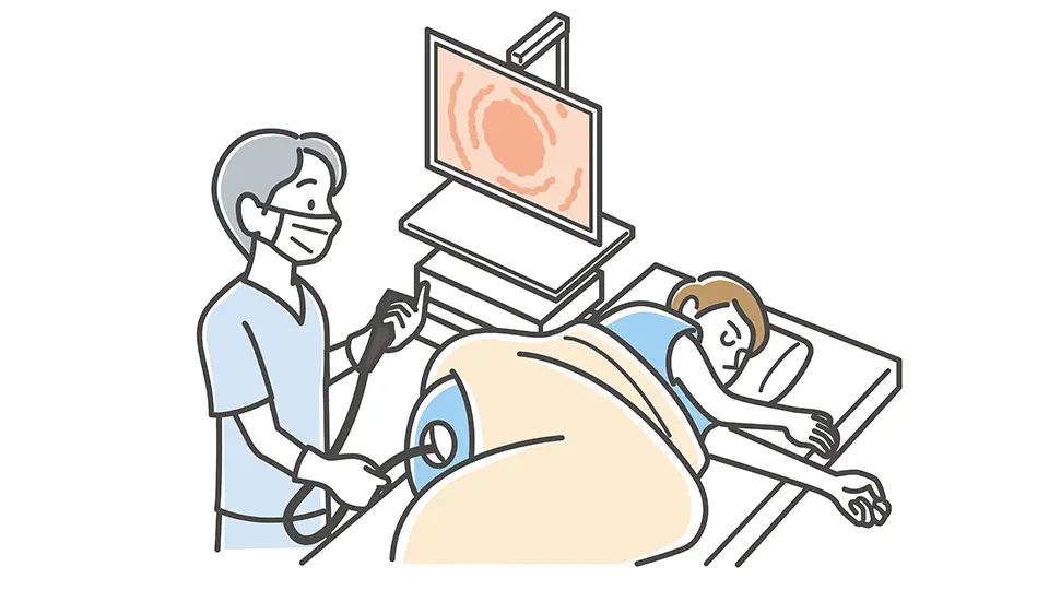 大腸内視鏡検査