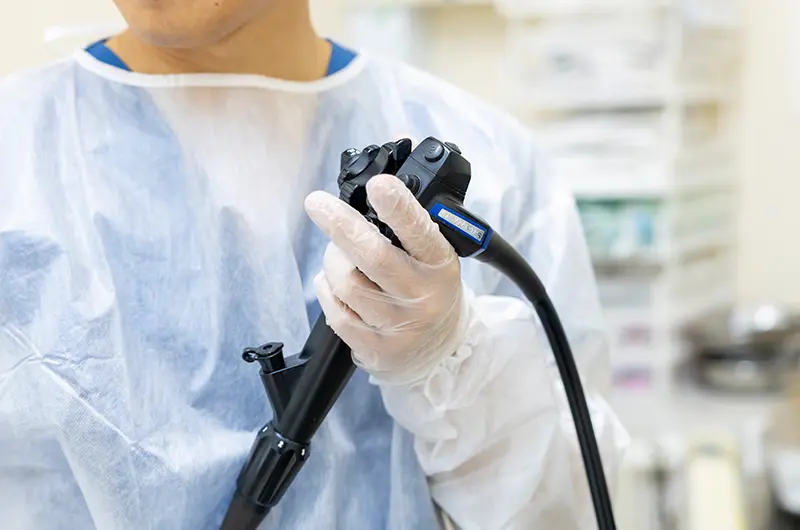 内視鏡検査で病気を早期発見